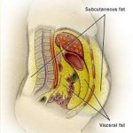 visceral fat